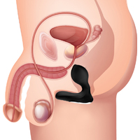5" Inflatable Prostate Massager